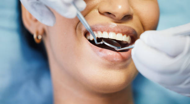 Best Broken or Chipped Tooth Repair in Marathon, FL